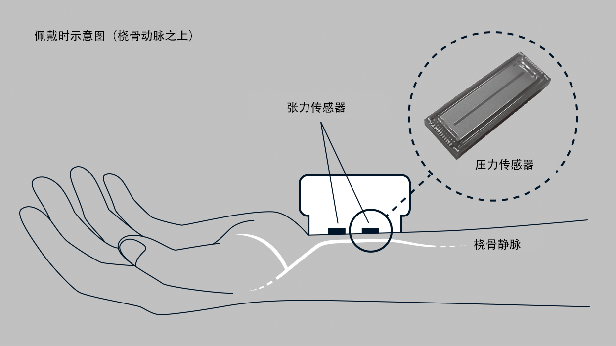 手首に機器をつけるだけで1拍ごとの血圧を測定できる、オムロン独自の圧力センサー